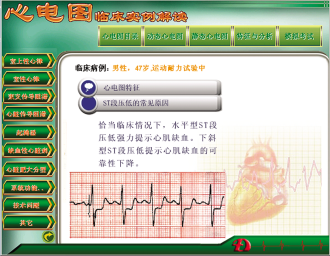 Updated ECG Teaching Software product image 1