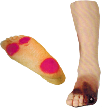 Diabetic Foot Demonstration Model product image 1