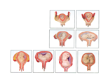 Obstetrics and Gynecology Training Model - Item 18016 product image 1