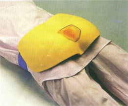 Pressure Sore Nursing Model product image 1