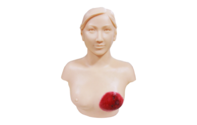 Advanced Breast Carbuncle Diagnosis Training Model product image 1