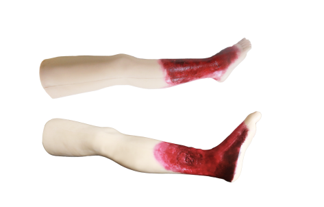 Advanced Erysipelas Diagnosis Training Model product image 1
