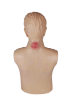 Advanced Carbuncle Diagnosis Model product image 1