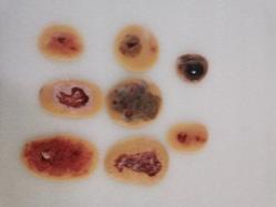 TCM Surgical Disease Model Set product image 1